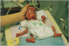 Hrvatsko društvo za dječju kirurgiju